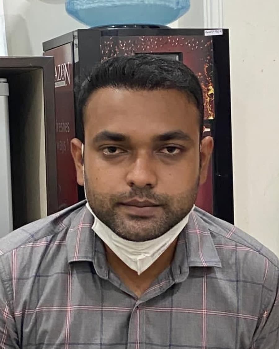 Rinova patient hair restoration result — after treatment